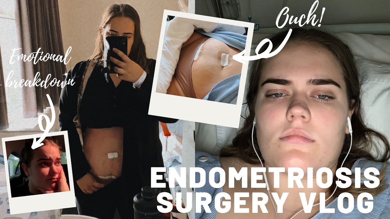 ENDOMETRIOSIS // Surgery Vlog - finally being diagnosed!!