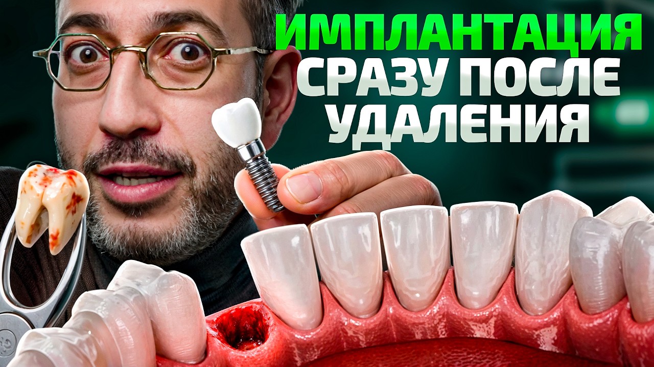 Имплантировать или ждать? – Что делать после удаления зуба