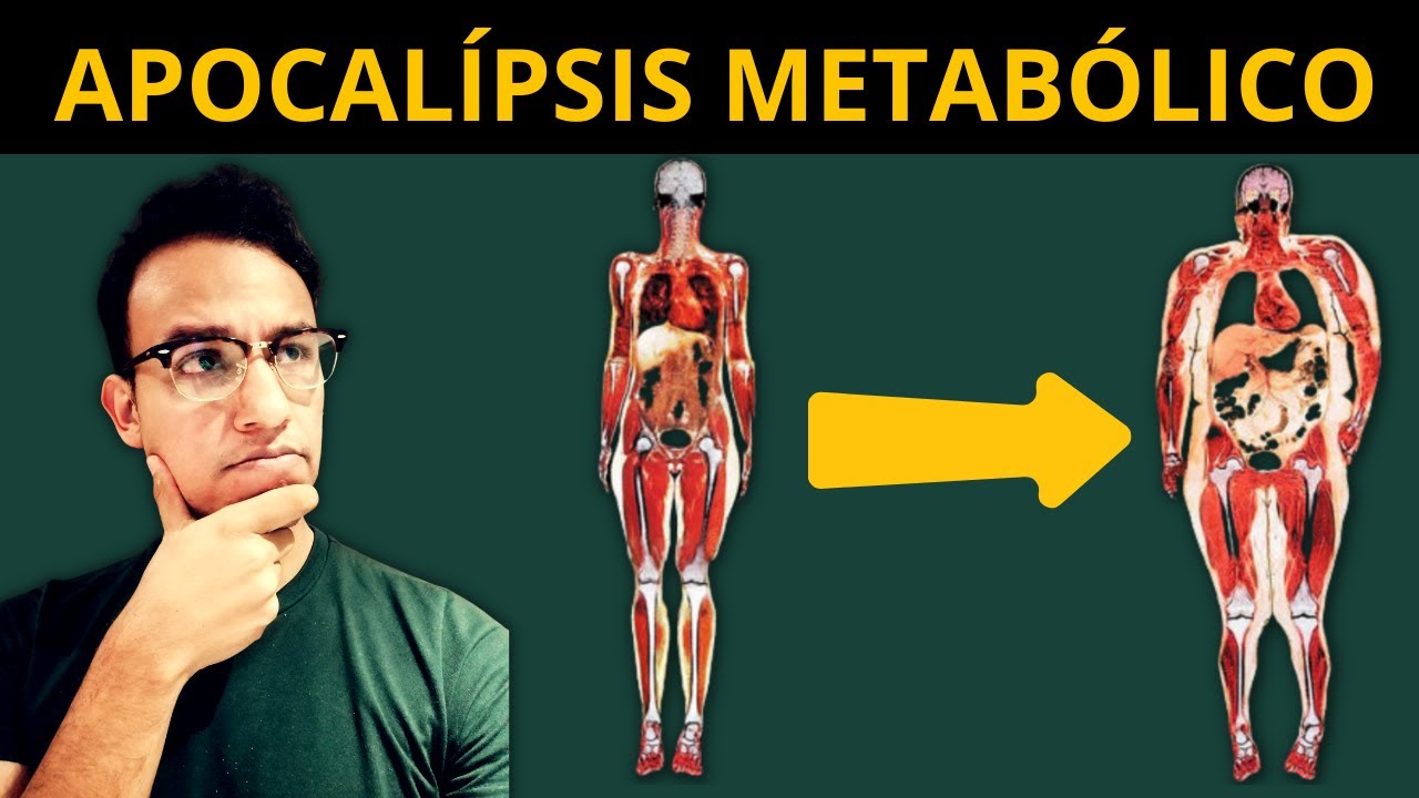 Los 4 JINETES del APOCALIPSIS METABÓLICO: metainflamación, sarcopenia, resistencia a insulina