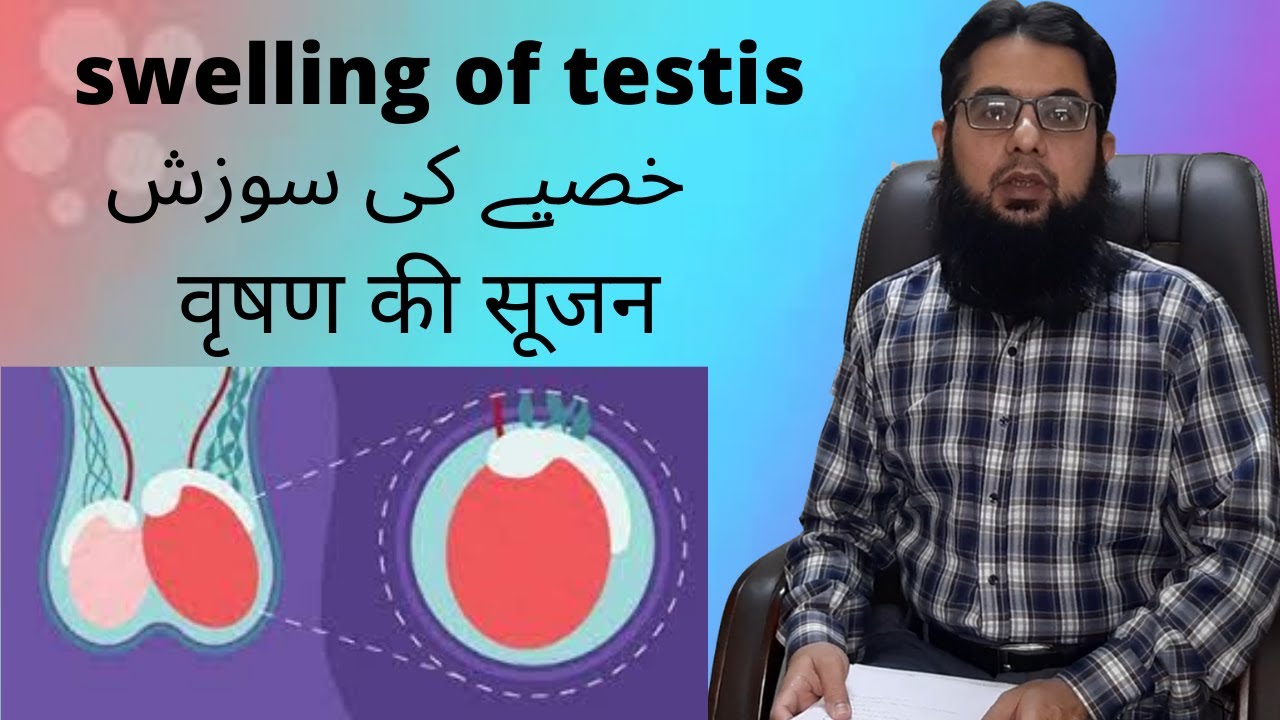 swelling of testis / khasyee ki sozish / خصیے کی سوزش   वृषण की सूजन