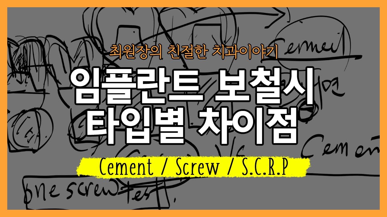 임플란트 보철 타입 스크류, 세멘, SCRP에 관하여