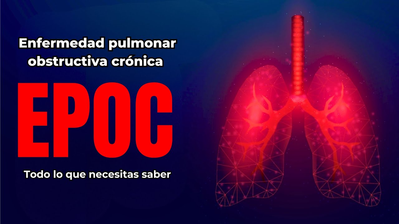 Enfermedad Pulmonar Obstructiva Cr&oacute;nica (EPOC): Etapas, Causas, Tratamiento
