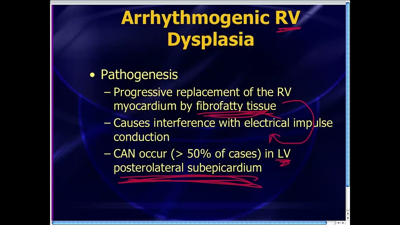 Amal Mattu's ECG Case of the Week_ June 23, 2014