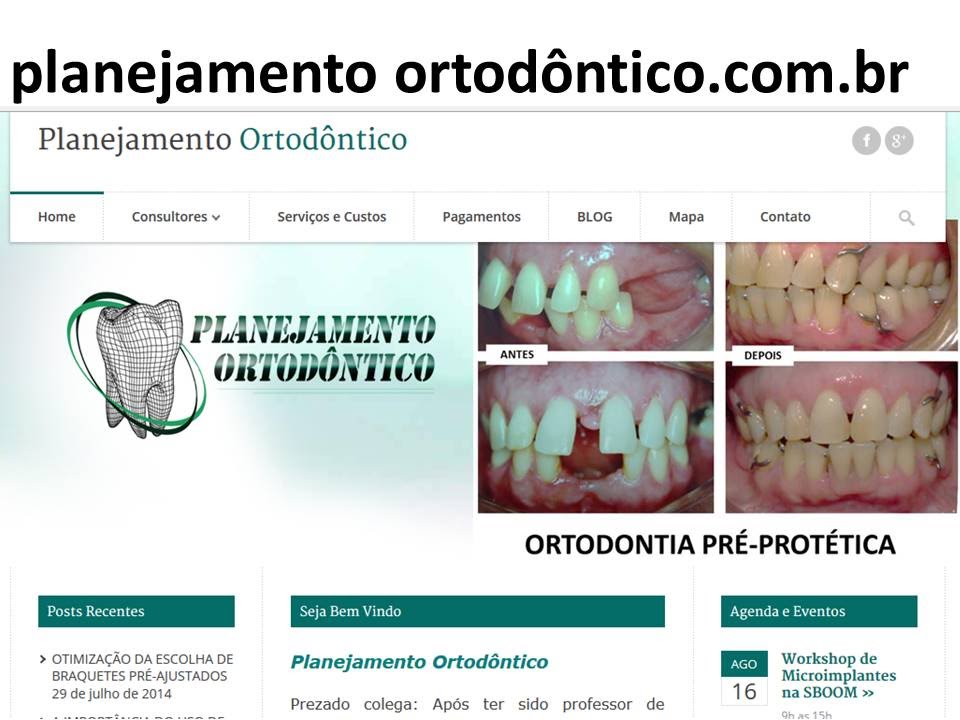 Ativação quadrihélice Quad Helix activation