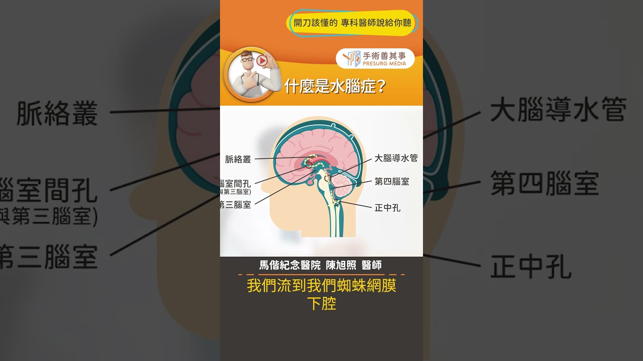 【水腦症是什麼？】#水腦症 #腦水腫 #引流手術 #手術善其事 #陳旭照醫師