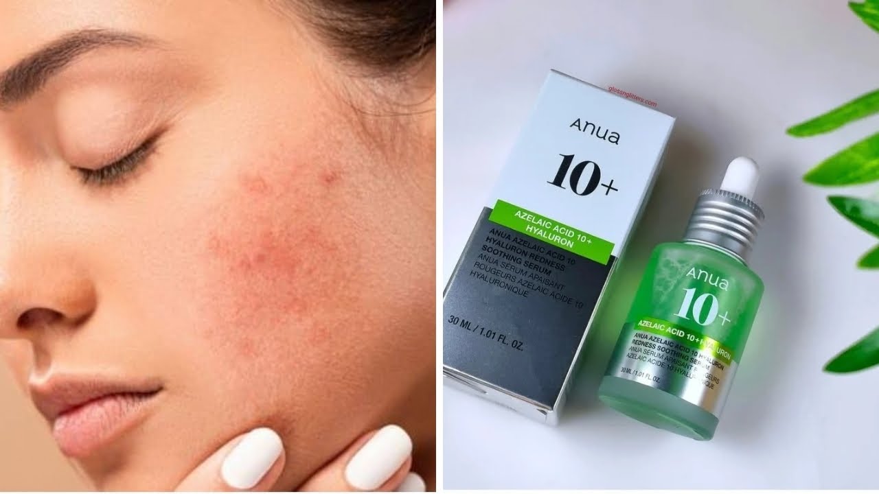 ব্রণ,কালো দাগ দূর করুন মাএ ১৫ দিনে। Anua 10+ azelaic acid 10+ hyaluron serum. Anua serum.