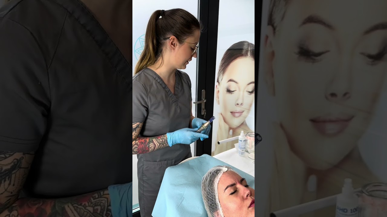 Mezoterapia mikroigłowa - Perfect Look Clinic