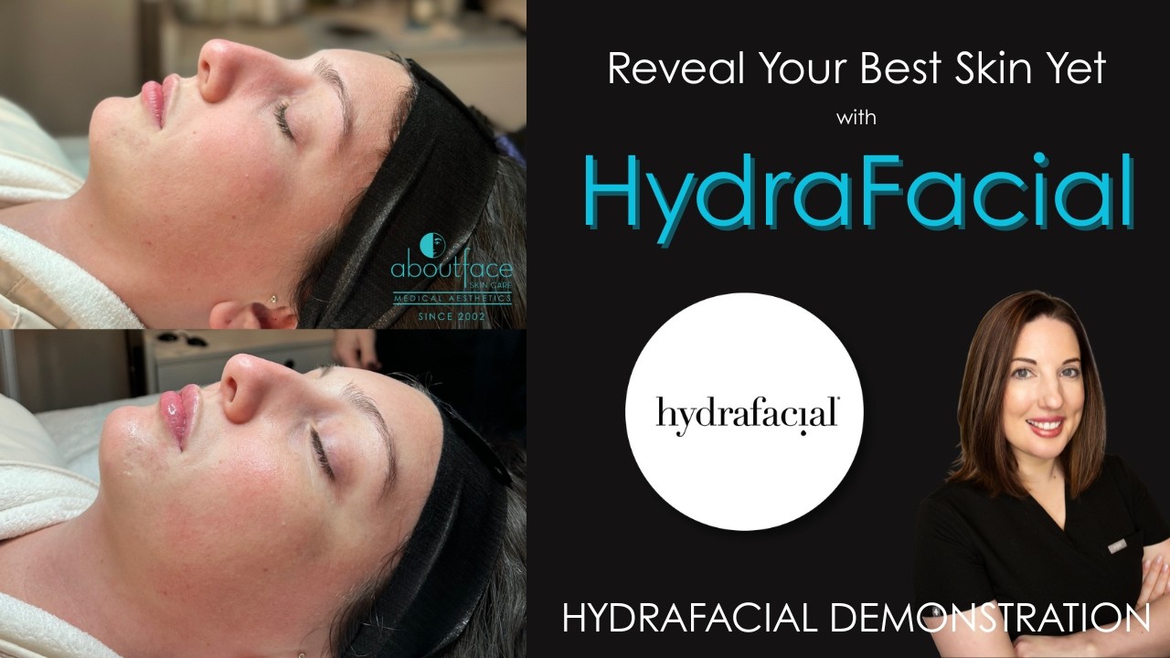 HydraFacial Demo | Reveal Your Best Skin Yet