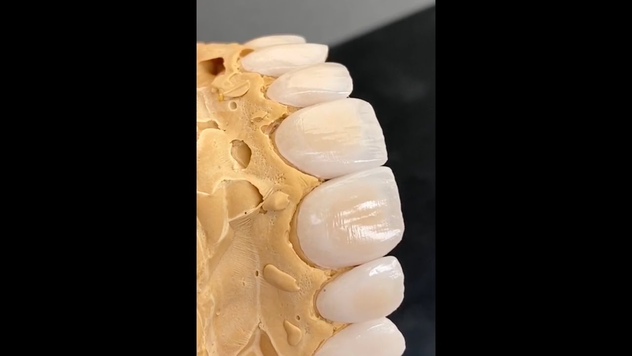 Feldspathic Техника нанесения керамики на рефракторе Noritake зубной техник dental technician