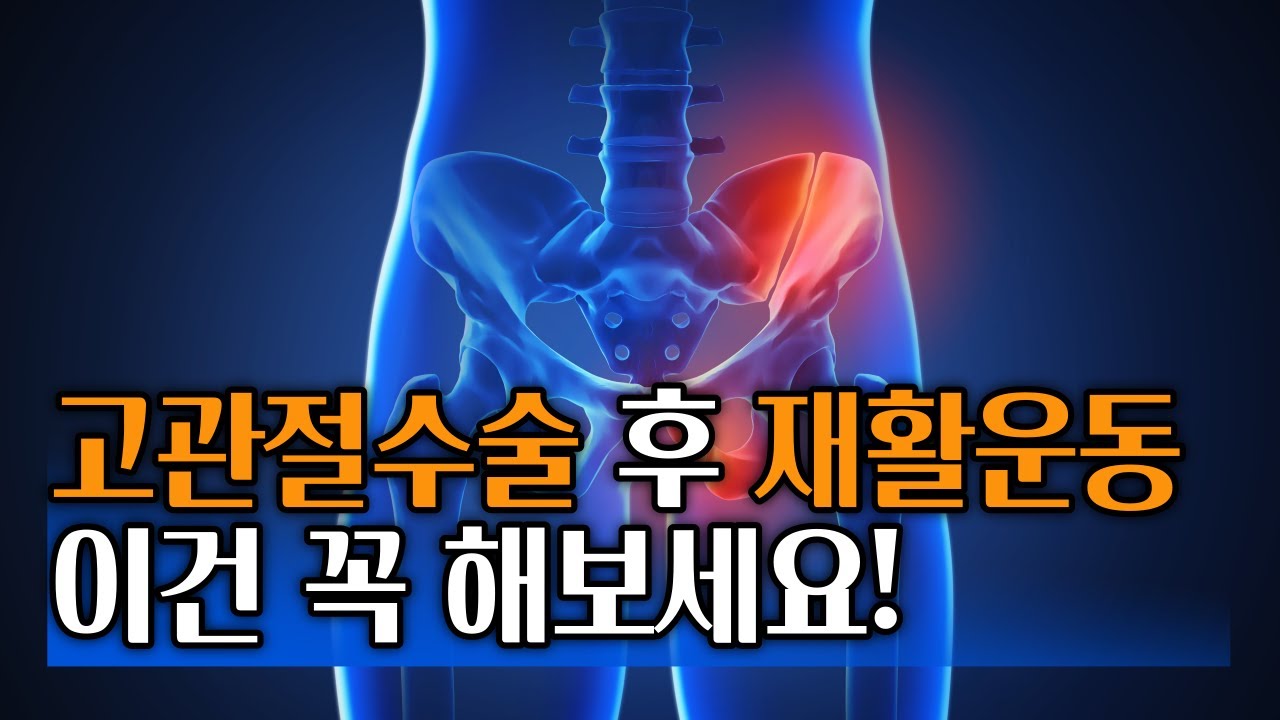 고관절 수술 후 재활운동
