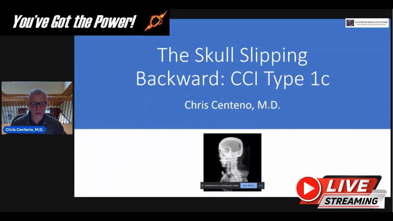 The Skull Slipping Backward: CCI Type 1c