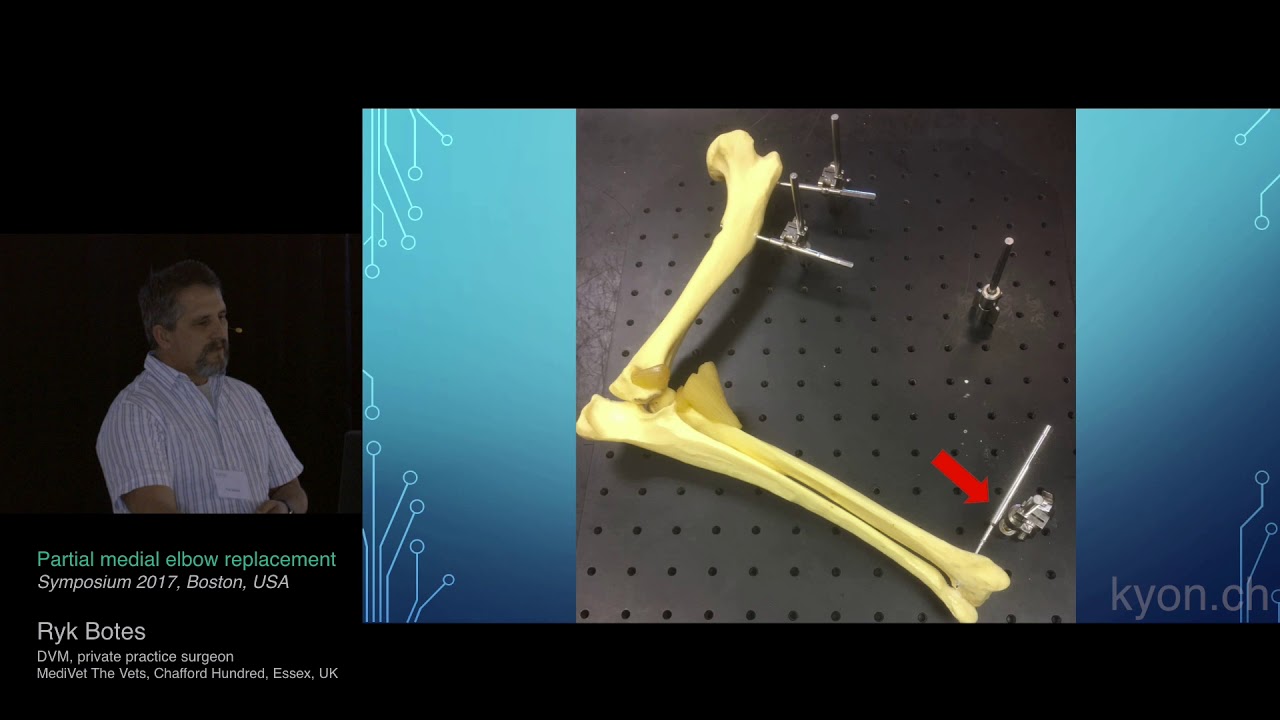 Partial Medial Elbow Replacement -- Dr. Ryk Botes at KYON Symposium 2017, Boston, US #elbowdysplasia
