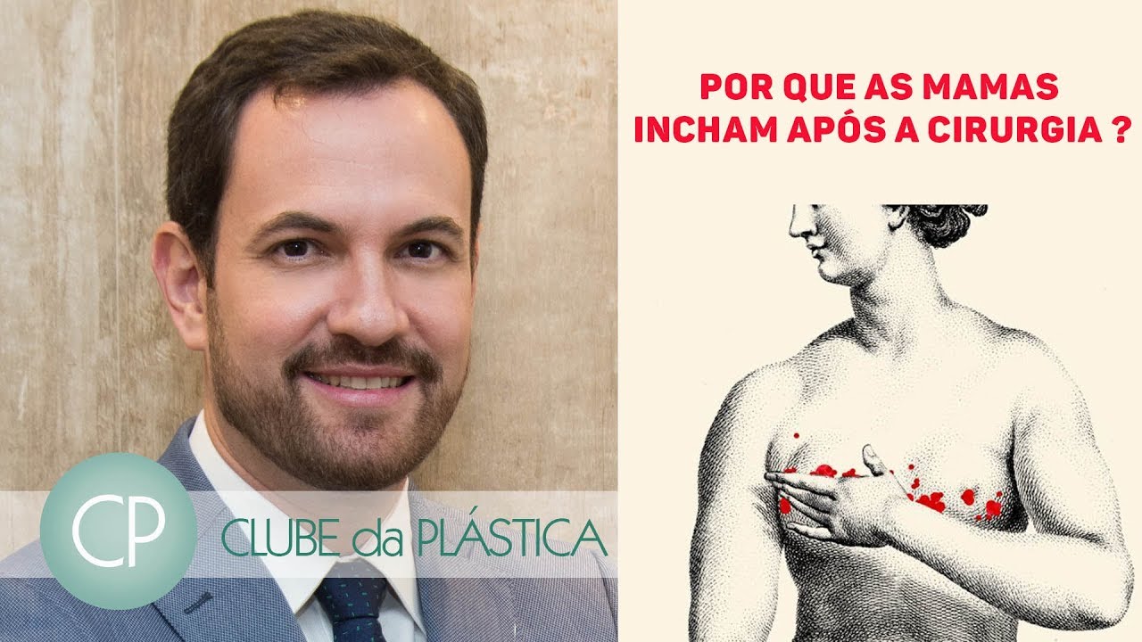 Clube da Plástica - Por que as mamas incham após a cirurgia ?