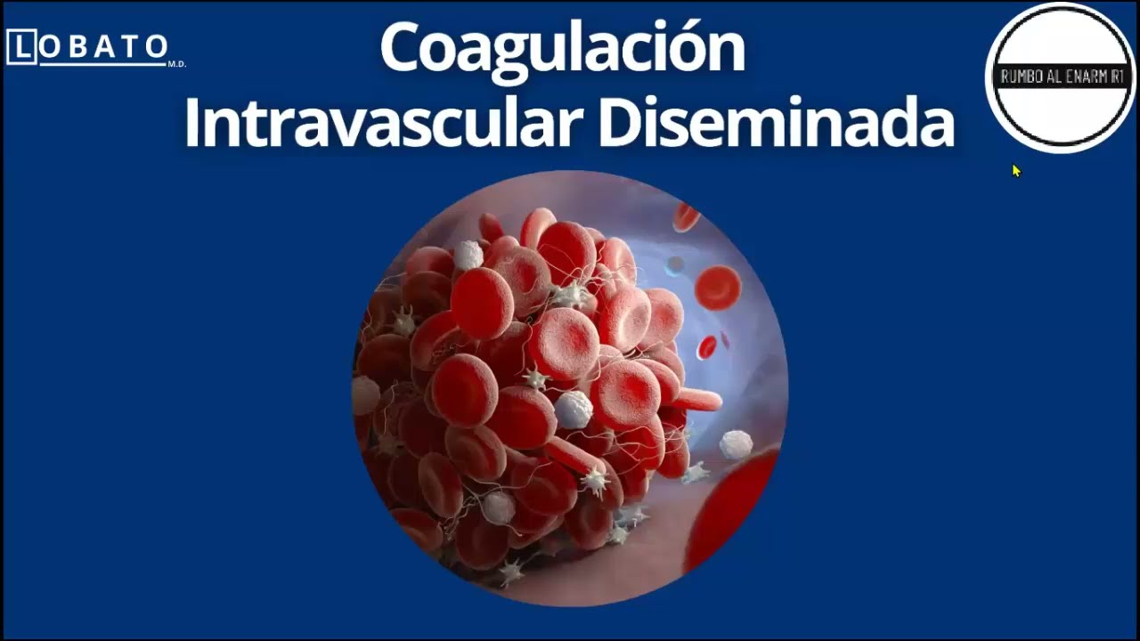 Coagulación Intravascular Diseminada 🩺 CID | ENARM | Diagnóstico y Tratamiento