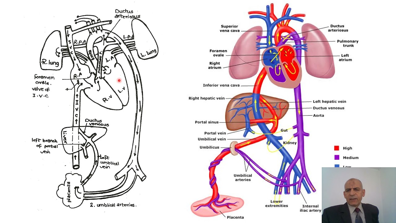 Foetal Circulation - Postnatal changes- Foramen ovale - Ductus arteriosus - Ductus venosus -