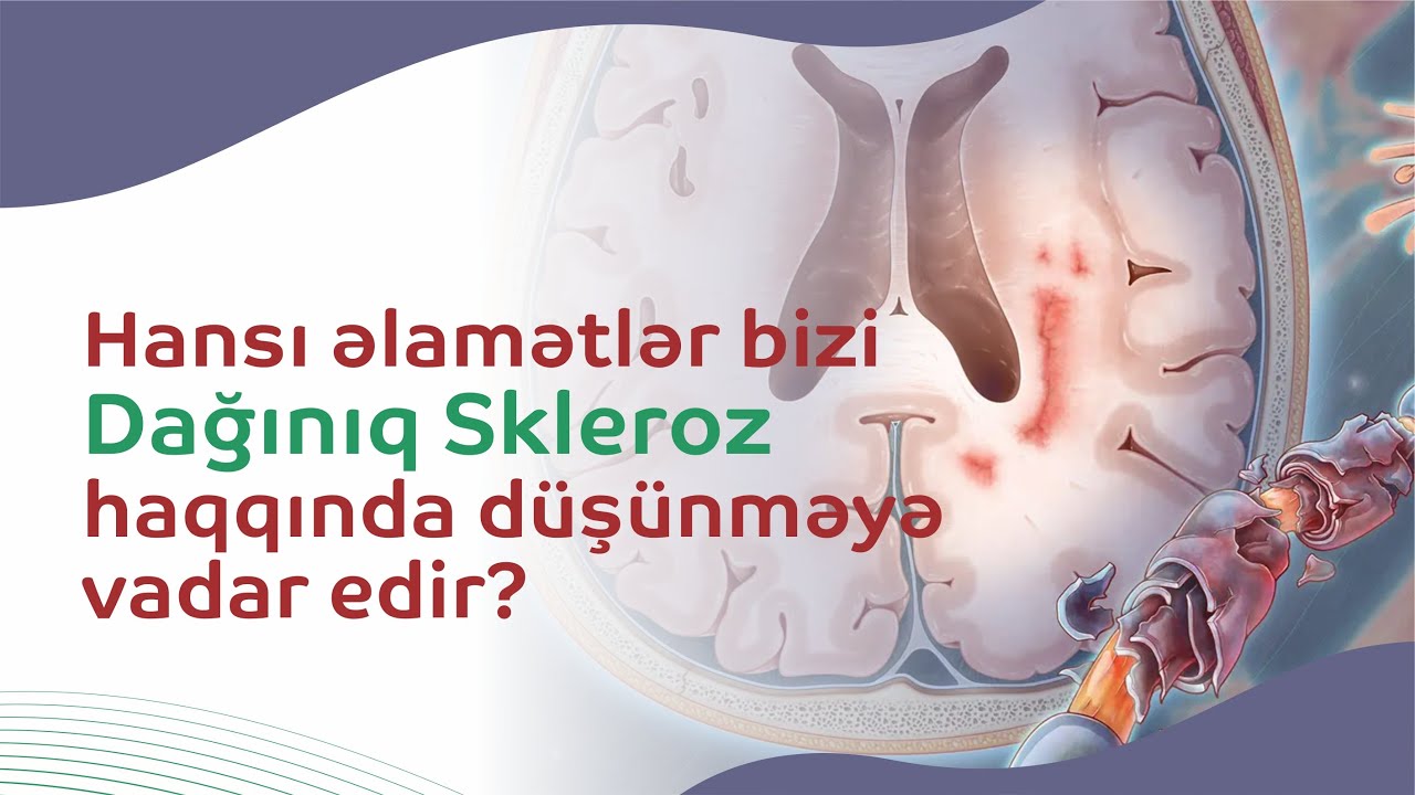Hansı əlamətlər bizi Dağınıq Skleroz haqqında düşünməyə vadar edir?