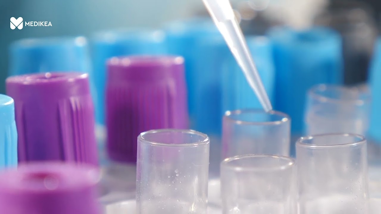 Trapianto di rene nei pazienti iperimmuni: le nuove frontiere della ricerca scientifica