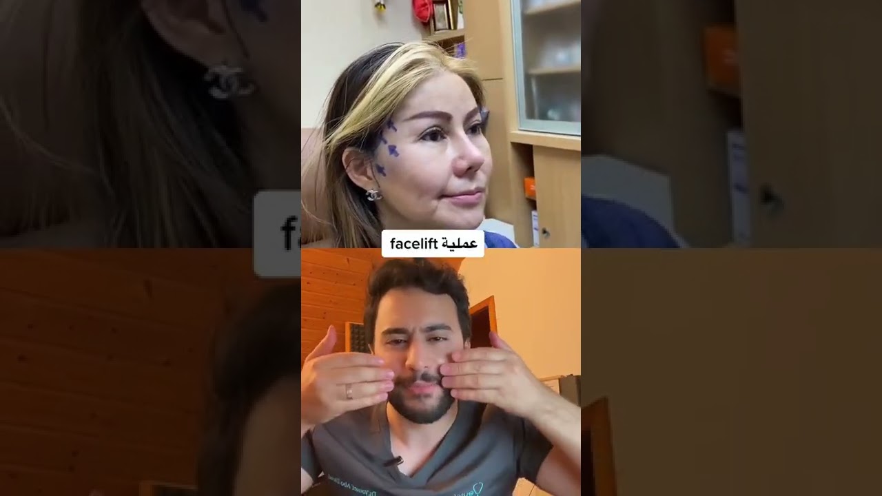 مشاكل عمليات التجميل 😳 | دكتور يوسف