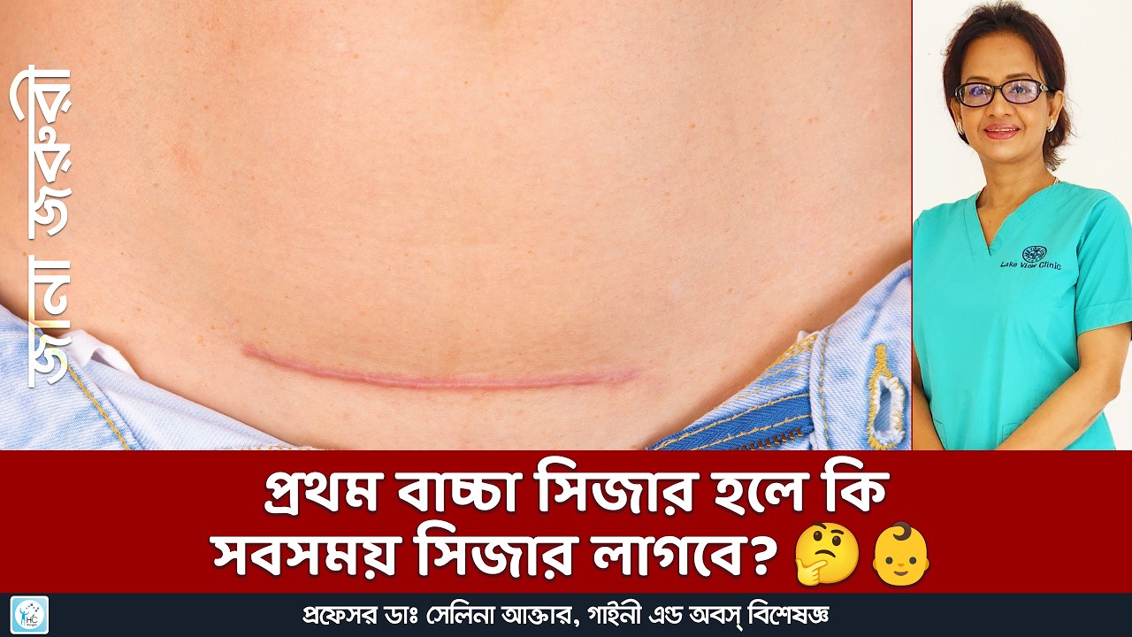 সিজারিয়ান ডেলিভারি: কেন, কখন এবং কীভাবে? ডাক্তারদের পরামর্শ ও ভুল ধারণা ।