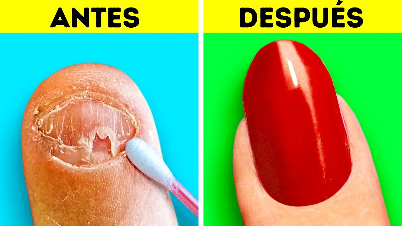 Transformación asombrosa de uñas || Trucos femeninos de belleza