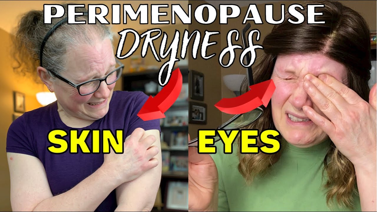 Dealing with dryness in menopause.  Dry skin/dry eyes in middle aged women. Perimenopause symptoms.