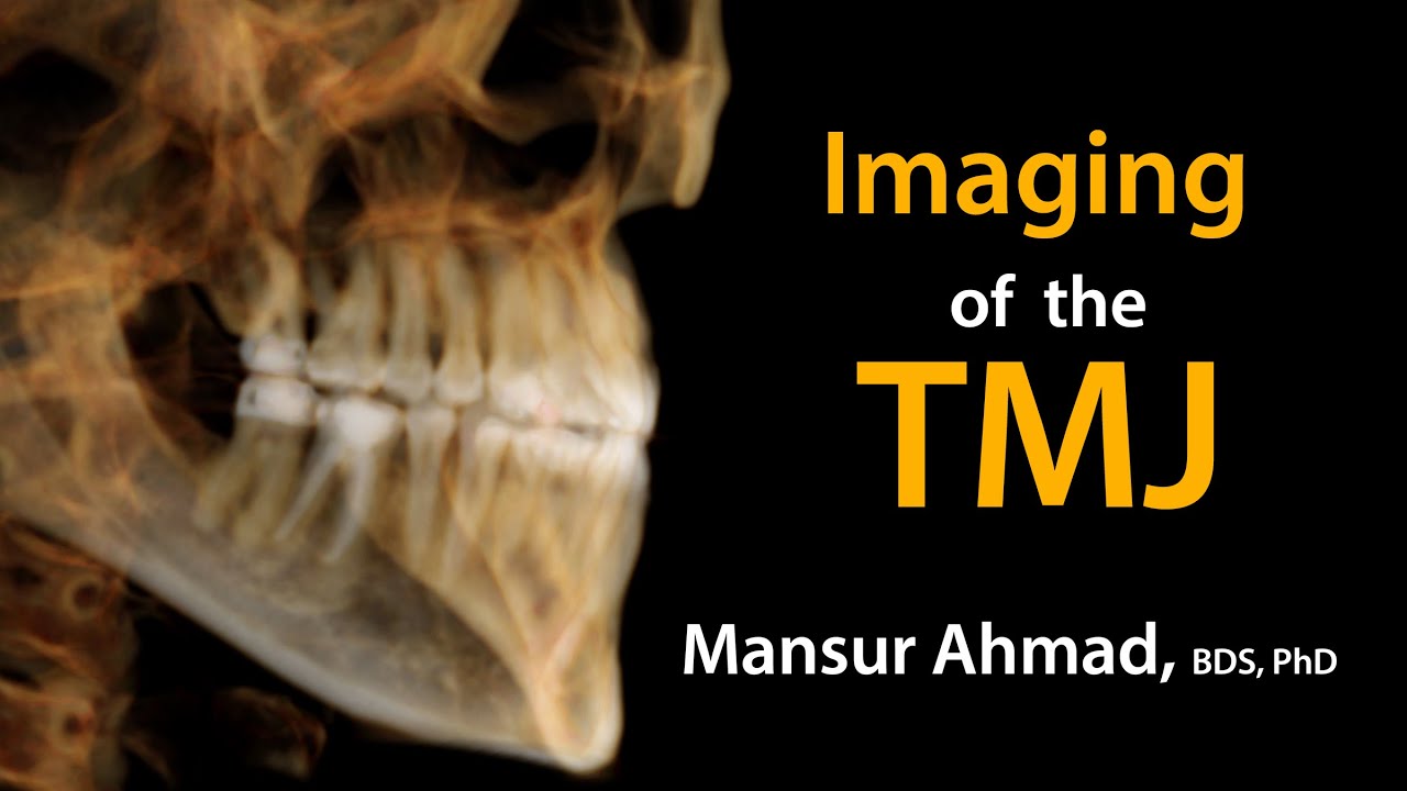 Imaging of the TMJ
