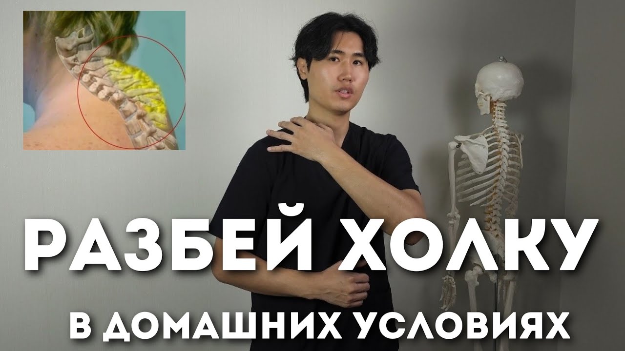 Разбил холку в домашних условиях при помощи этих упражнений. Вдовий горб, жировой бугор.