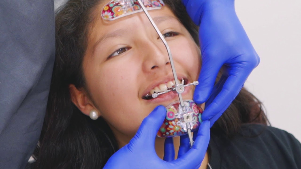 Ortopedia Facial