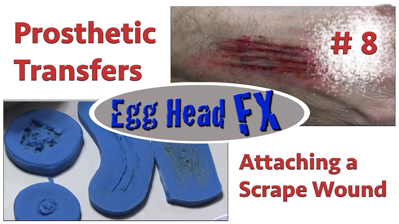 Prosthetic Transfers- Attaching The Scrape Wound - Part 8