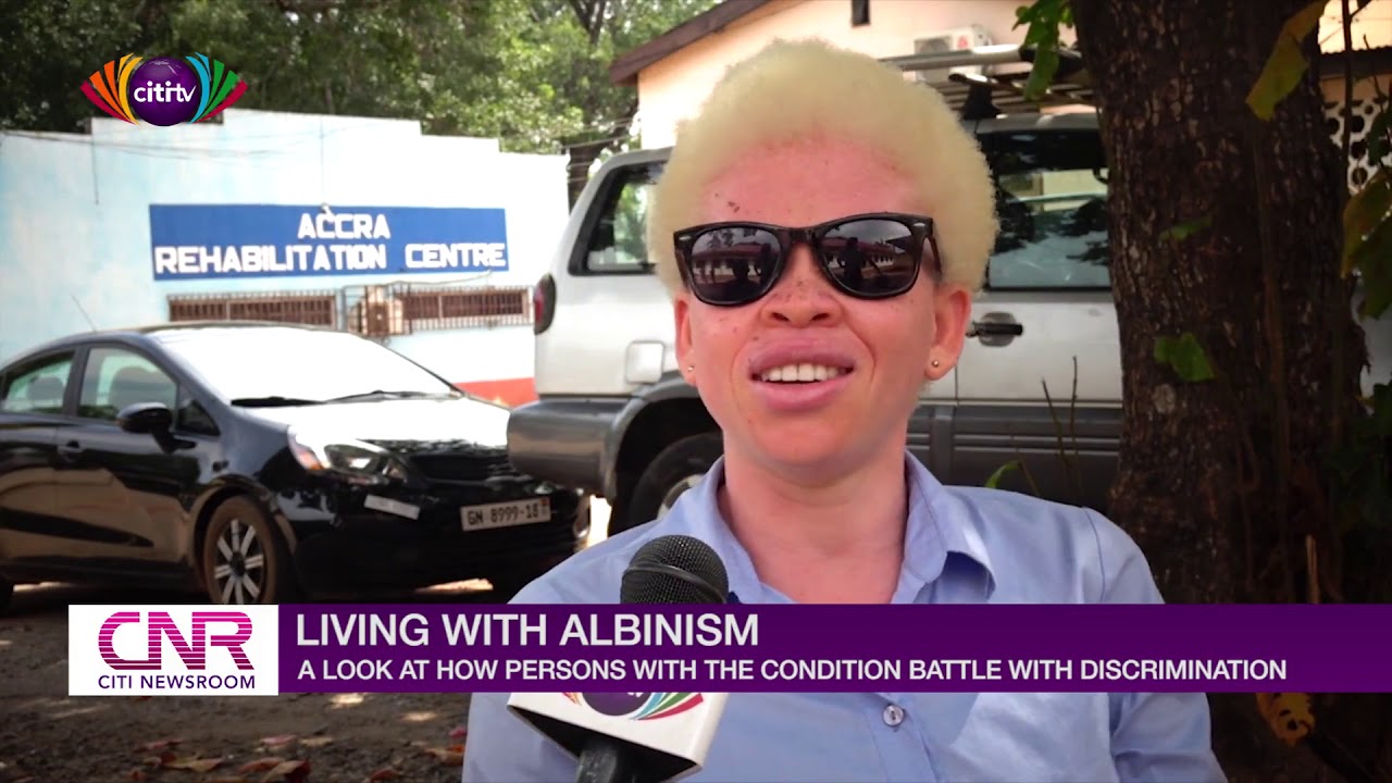 Living with Albinism: A look at how persons living with the condition battle with discrimination
