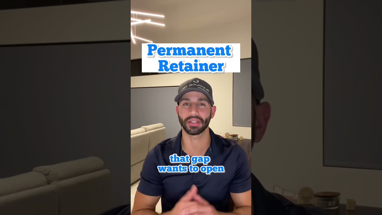 Permanent Retainer: When I decide to use them.