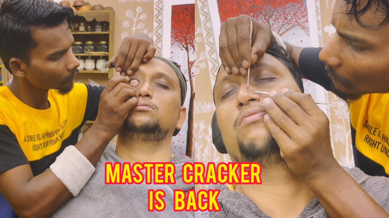 Black Head Removal with Eye Cleaning by The Legend Master Cracker
