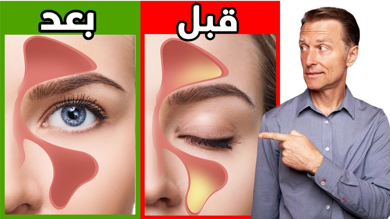 أفضل طريقة لتنظيف الجيوب الأنفية وفتح الأنف المسدود والتخلص من الاحتقان وتراكم المخاط