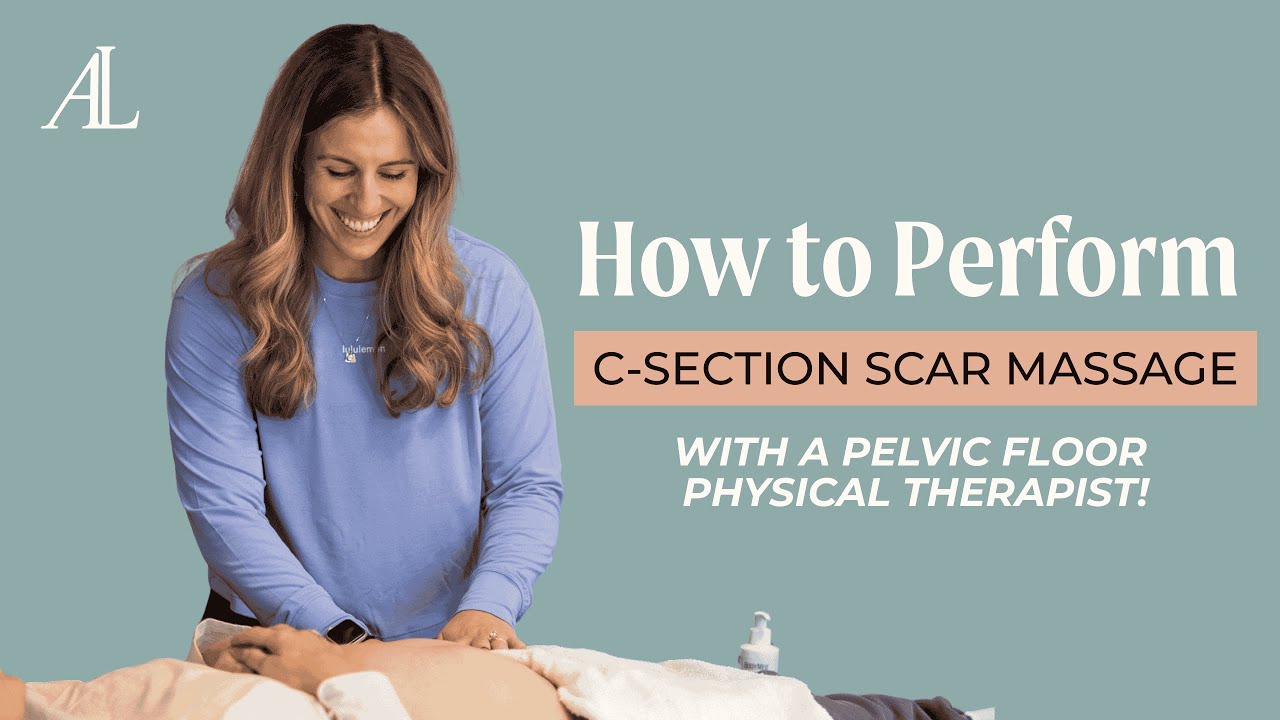 How to Perform C-Section Scar Massage