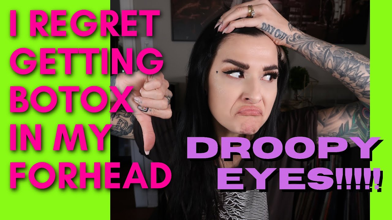 I REGET GETTING BOTOX/DYSPORT in my forehead! What you need to know before getting injections.