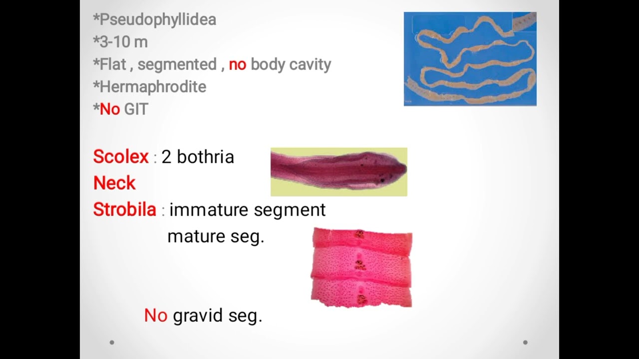 Diphyllobothrium Latum(broad fish tapeworm) ديدان السمك الشريطية