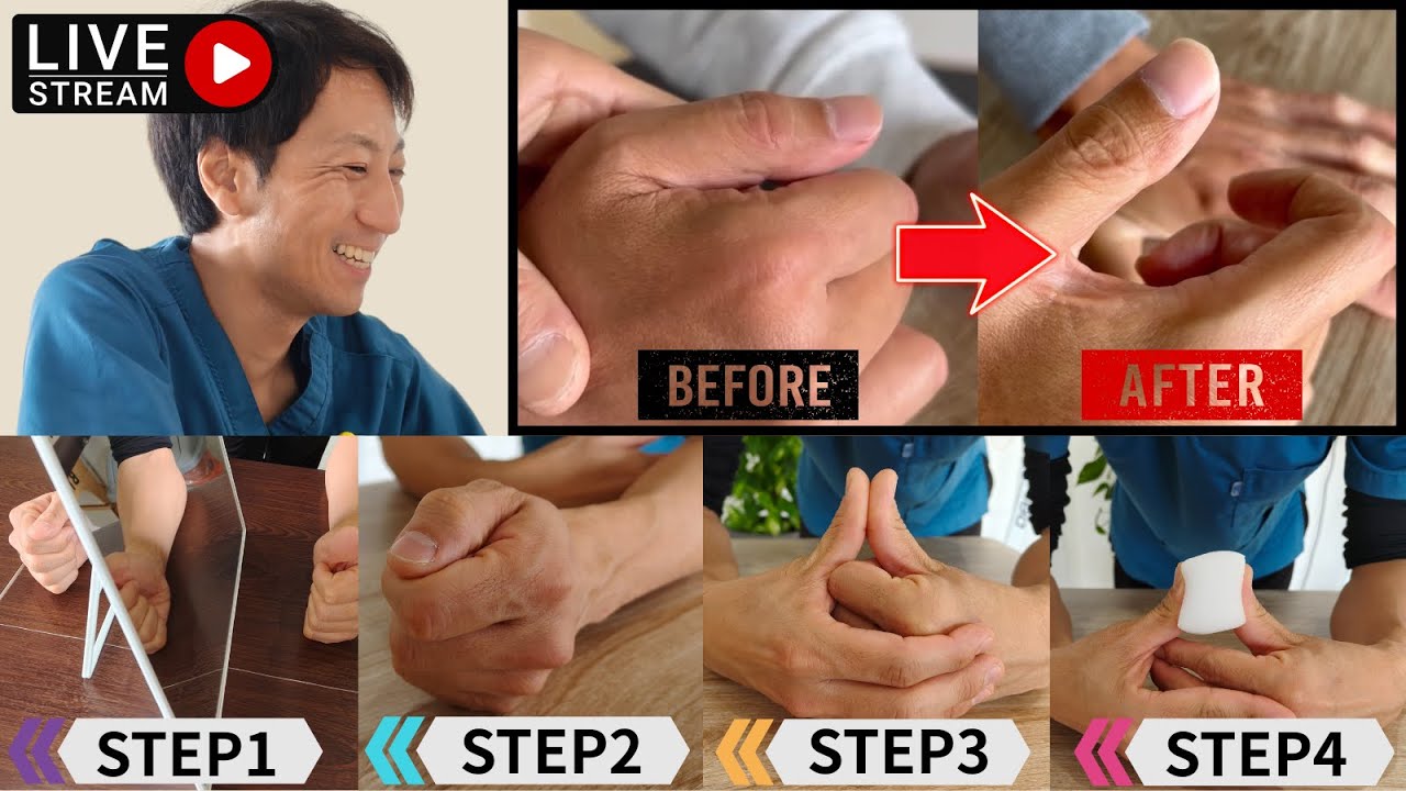 【親指リハ4STEP】脳卒中後、親指が全く動かない状態から動き出した時に行った実際のリハビリ