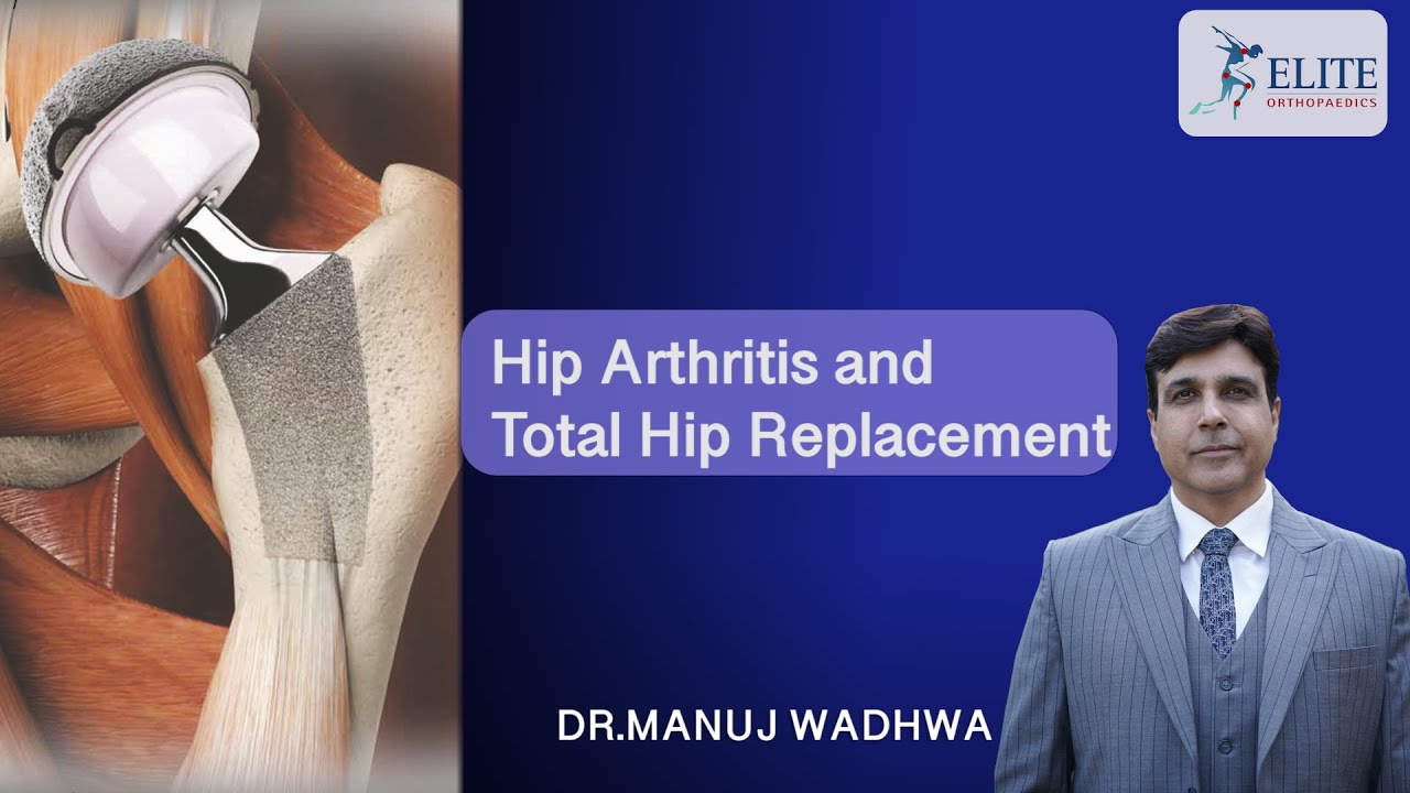Hip Arthritis and Total Hip Replacement | Dr. Manuj Wadhwa | Elite Ortho India