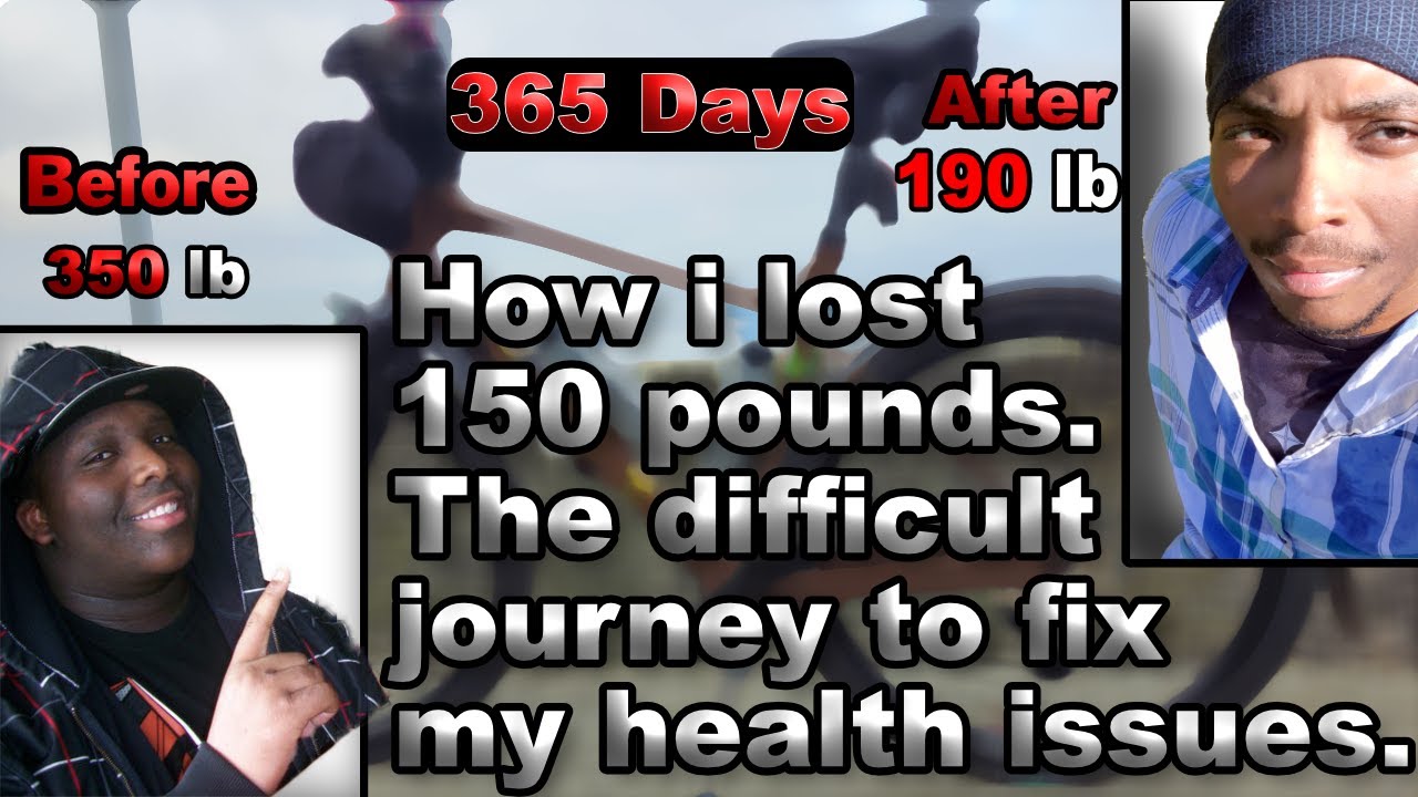 How I lost 150 pounds in 1 year, weighing the Pros, Cons and other health issues.
