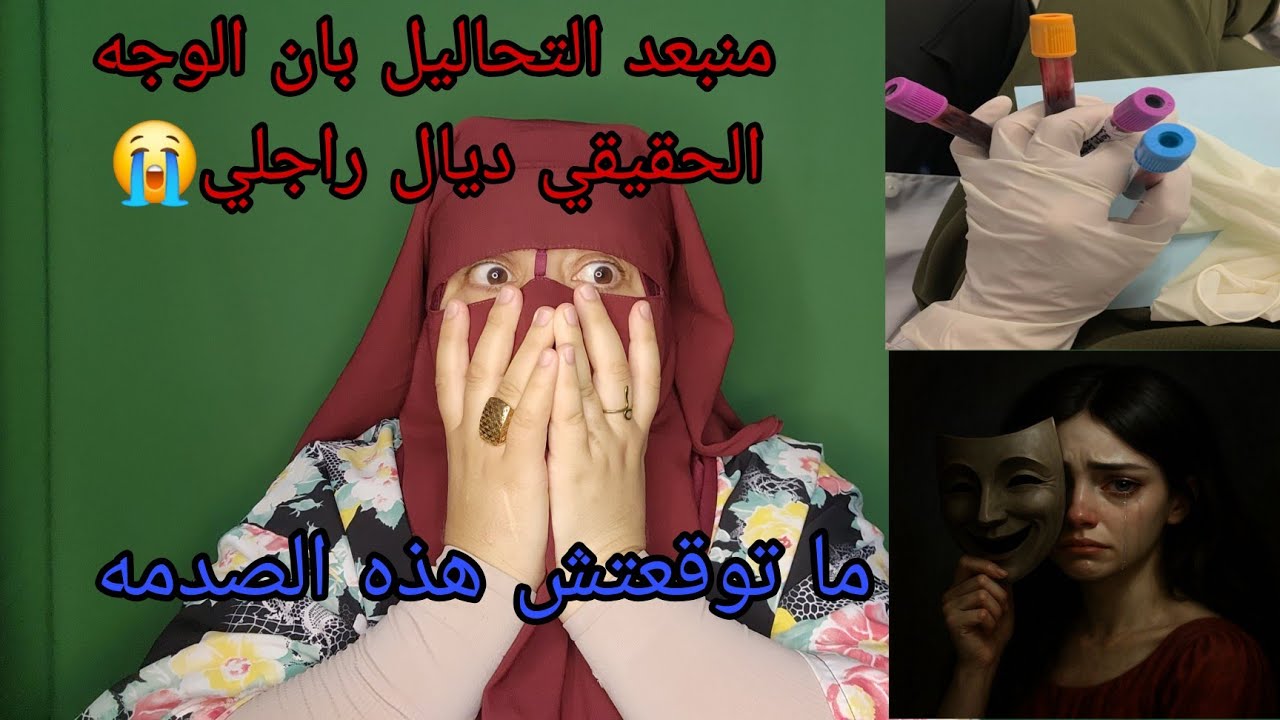 من بعد ما خرجوا التحاليل لقيت الصدمه😭 عرفت الحقيقه ديال رجلي اللي هو اكبر.....😭