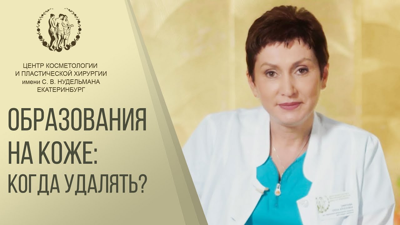 👌 Безопасное удаление родинок в Екатеринбурге. Удалить родинку Екатеринбург. Клиника Нудельман. 12+
