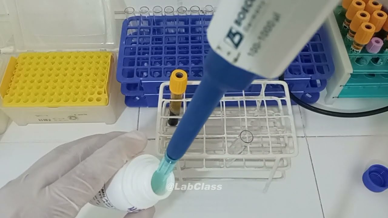 Diagnóstico de Pancreatitis: Test de Amilasa y Lipasa (Procedimiento)