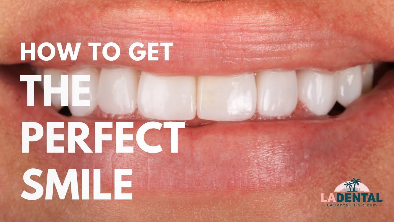 How to Get the Perfect, Natural Smile | Smile Makeover Explained by LA’s Top Cosmetic Dentists