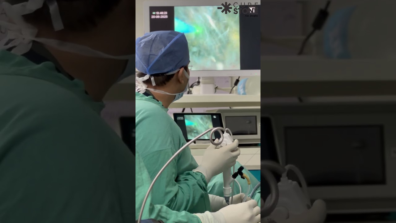 Life of a Surgeon | How kidney stones are removed | rirs #kidneyday #renalcare