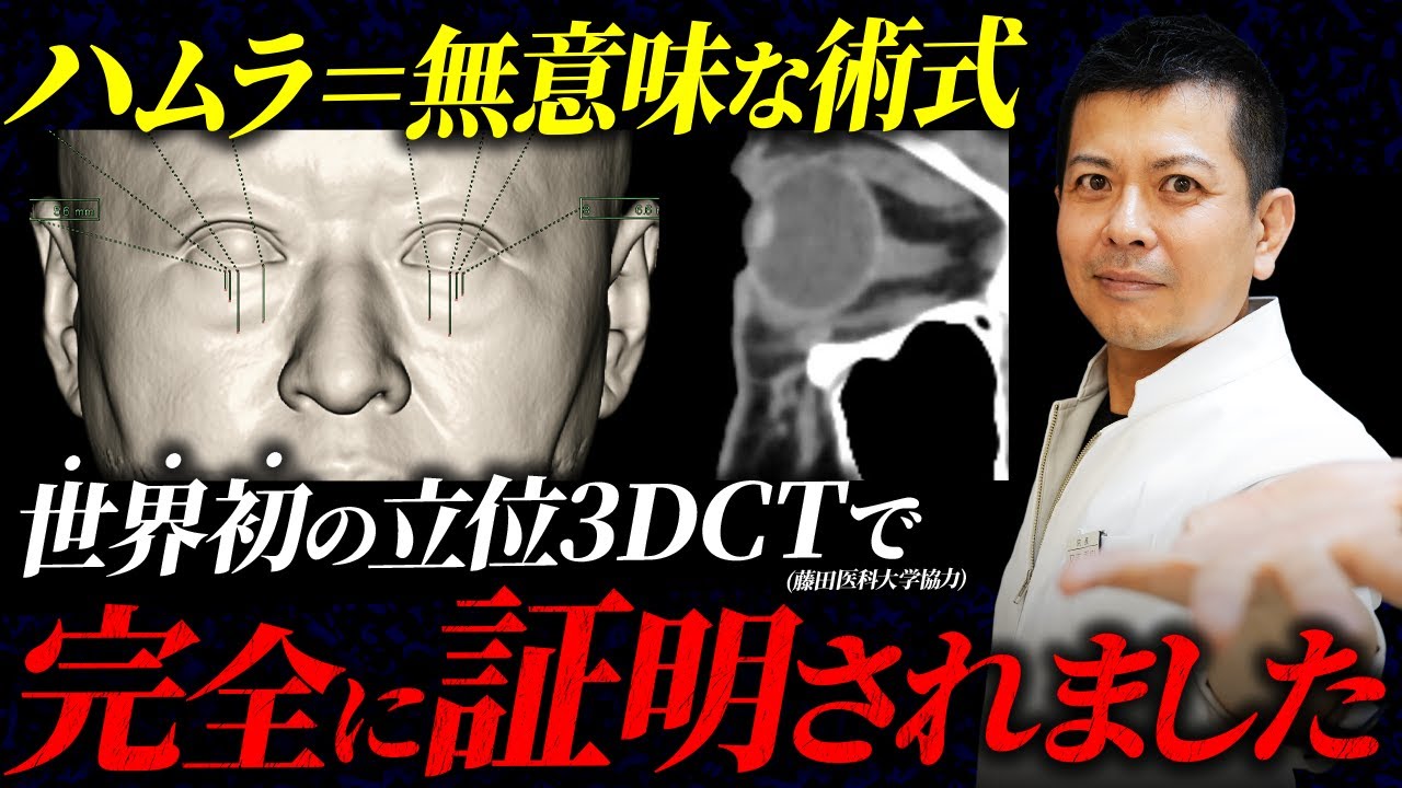 やっぱりハムラは嘘だった…立位3DCTでハムラが意味のない術式であることを暴きます。【クマ取り/整形】