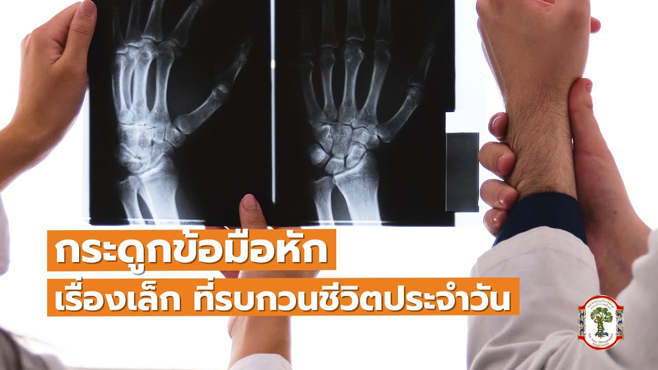 ไขทุกข้อกับหมอกระดูก กระดูกข้อมือหักเรื่องเล็กที่รบกวนชีวิตประจำวัน#สมาคมออร์โธปิดิกส์แห่งประเทศไทย