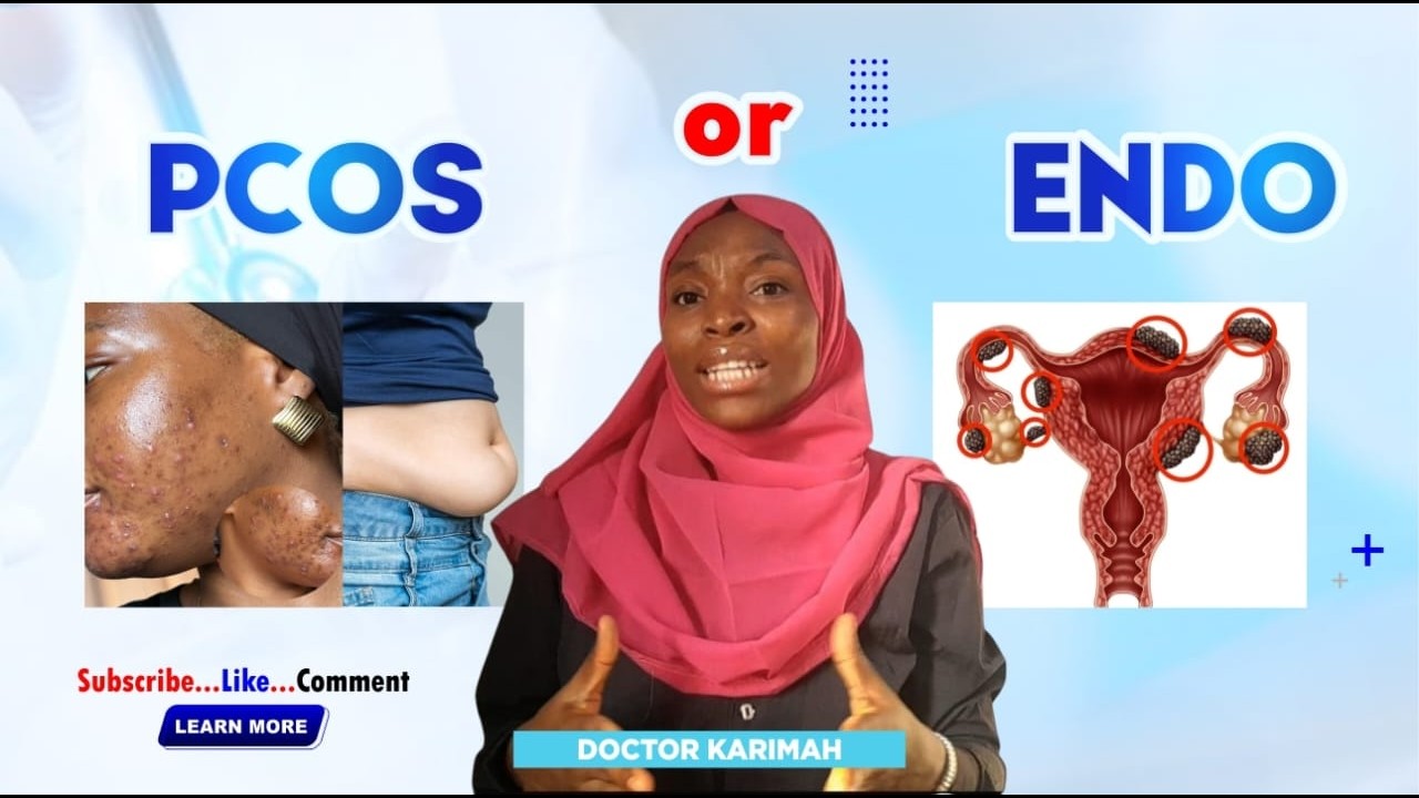 Pcos vs Endometriosis: The differences Most Women are never told