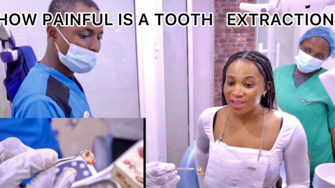 How painful is a tooth removal? Watch and find out!