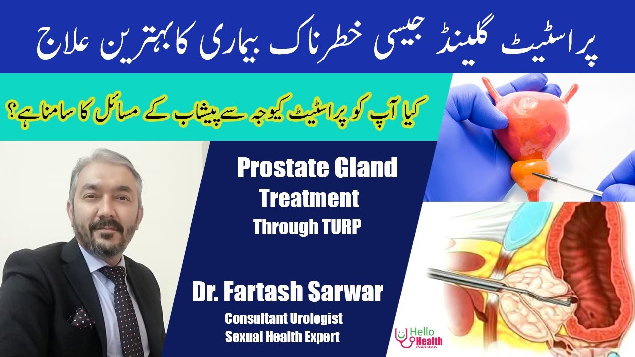 Prostate Gland Ka Ilaj | Prostate Gland Treatment | TURP | Dr. Fartash Sarwar