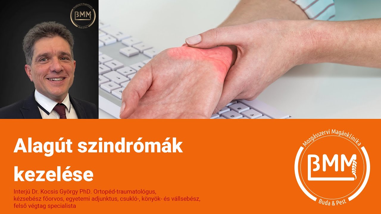 Mit kell tudni az alagút-szindrómákról?